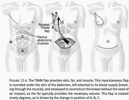 Women with different breast asymmetry testing the auto-adjustable